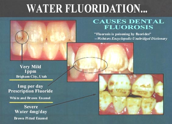 Dangers of Fluoride Listen To Your Gut
