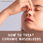 How To Treat Chronic Nosebleeds