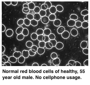 cell-normal