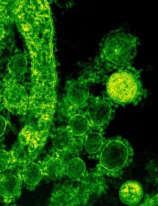 bacteria cells as seen under laser light