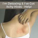 I’m Detoxing & I’ve Got Itchy Hives - Help!