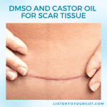 DMSO and Castor Oil for Scar Tissue