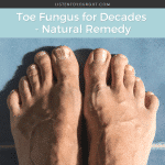 Toe Fungus for Decades Natural Remedy