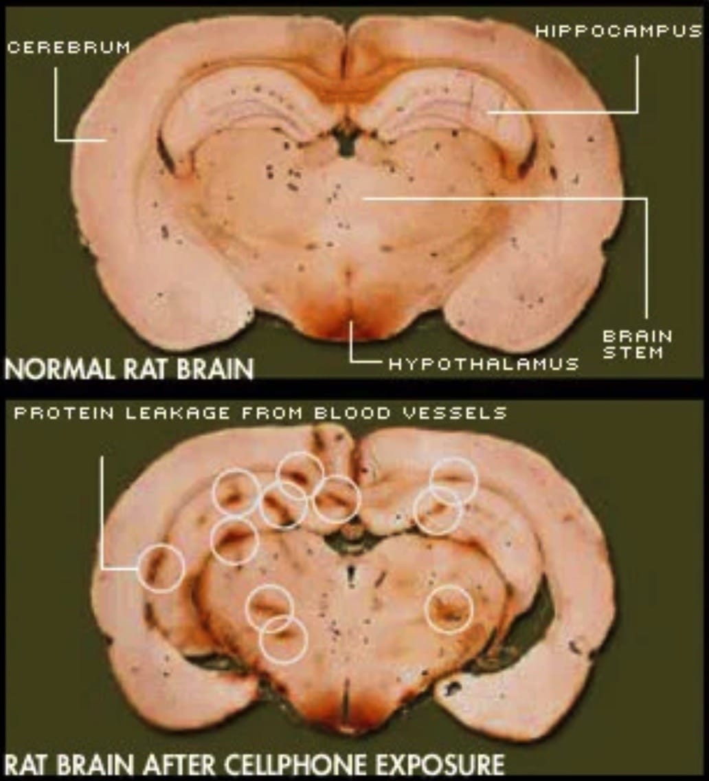 rat-brain.jpg